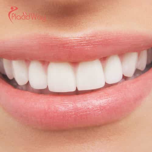 Full Mouth Rehabilitation in Colombia: Get Your Perfect Smile for Less, a Top Choice for Trinidad and Tobago Residents